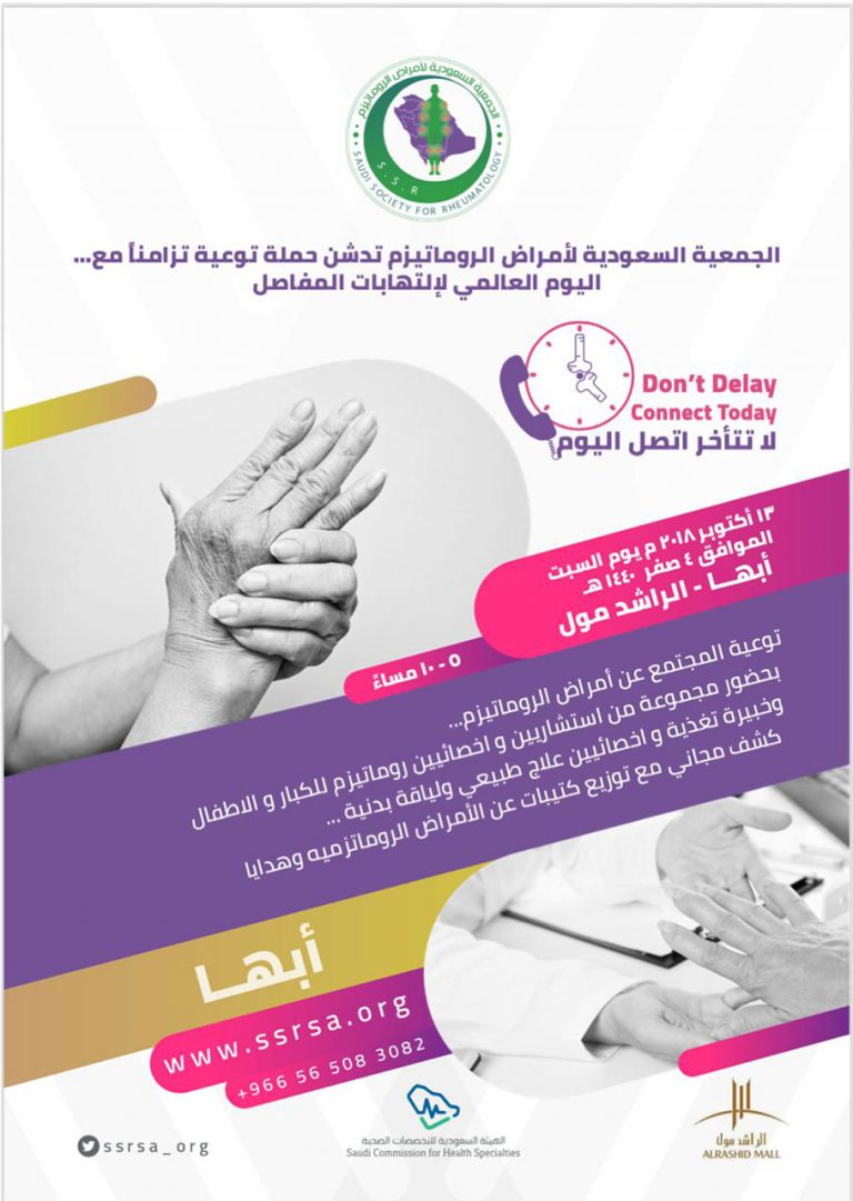 أبها